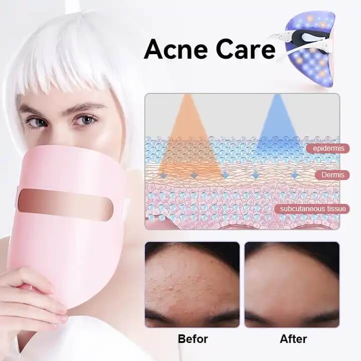 SKB-1818P Cuidados de beleza sem fio terapia de luz colorida led m&aacute;scara de terapia facial 