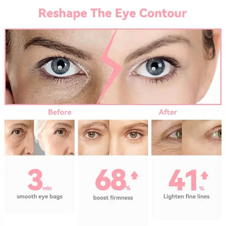 SKB-1807 El&eacute;trica Aquecida Vibra&ccedil;&atilde;o Anti Rugas Pen Eye Beauty Pen Hot Compress Eye Massager 